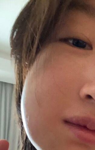 哪些明星拔智齿,明星们如何应对口腔烦恼