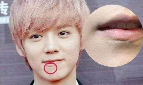 有疤痕能不能当明星,揭秘疤痕对明星职业的影响