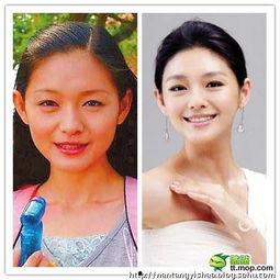 有什么明星削骨的,美丽背后的秘密